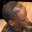 hairlineCheck